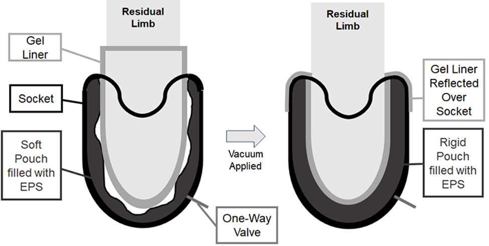 Creating an Adjustable Prosthesis for Aquatic Therapy infographic