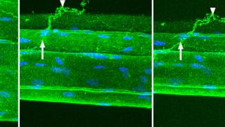 Collagen Cables