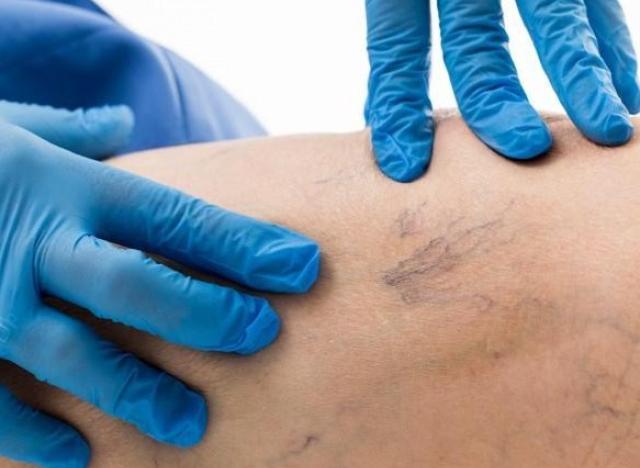 Gloved hands touching a leg